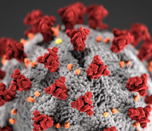 Monterey County reports first case of community-spread coronavirus COVID-19, novel coronavirus 2019